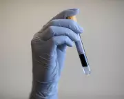 Targeted Prostate Screening Could Slash UK Deaths, Say Medical Experts