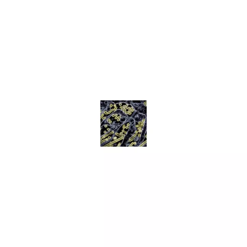 Man dies from novel H5N5 bird flu strain in first human case