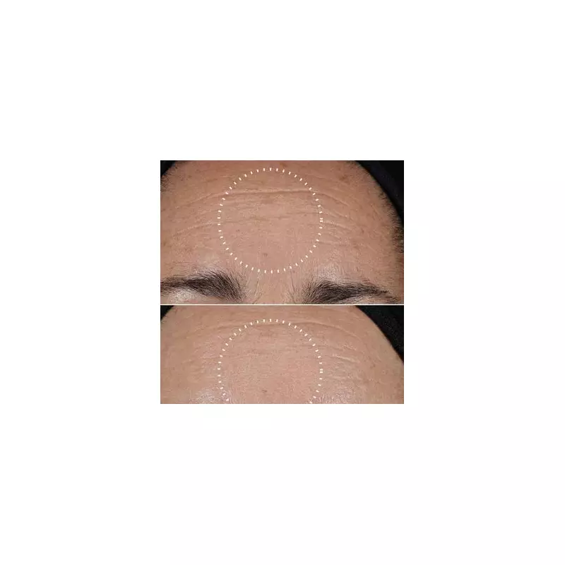 Save £33 on Medik8's Anti-Ageing Set That 'Replaced' Botox