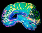 Cambridge Study Reveals Five Brain Epochs, But Ageing Stages Overlooked