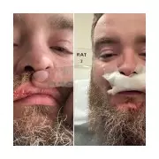 Huntingdon Train Suspect Accused in Prior Face Slashing Attack