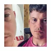 Ketamine at 16: How Party Drug Use Left Me With Permanent Bladder Damage