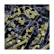 Man dies from novel H5N5 bird flu strain in first human case