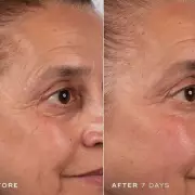 Medik8 slashes £19 off anti-ageing cream in Black Friday deal