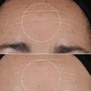 Save £33 on Medik8's Anti-Ageing Set That 'Replaced' Botox