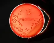 Superbug Deaths Rise 17% in England as Antibiotic Resistance Grows