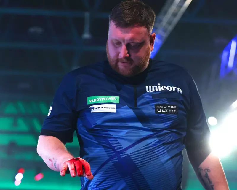 Cameron Menzies' Bloody Hand: A Parable of Darts' Dark Side at Ally Pally
