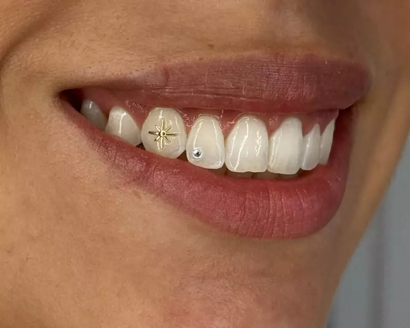 Tooth Gems Sparkle in Australia: A Trendy Grin or Dental Danger?