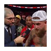 Jake Paul Spits Blood, Reveals Broken Jaw After Anthony Joshua Fight