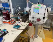 NHS to trial Dialive 'liver dialysis' device in bid to slash deadly ACLF death rates