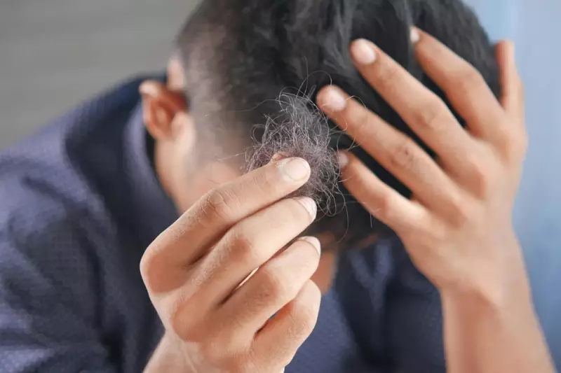 London Stress Crisis: 90% Report Hair Loss & Scalp Issues