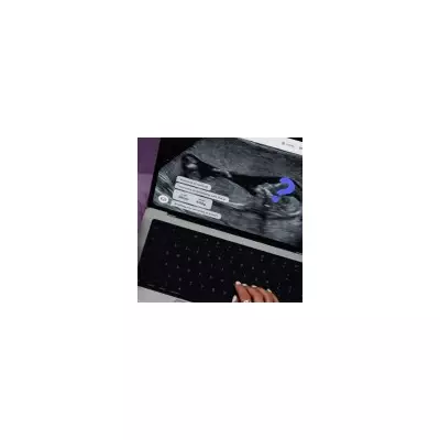 Ex Accuses Me of Baby-Trapping, But It's My Last Chance for Motherhood