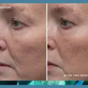 Elemis Anti-Ageing Cream Slashed to £80.75: Shoppers Rave About Wrinkle Results