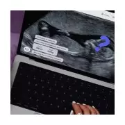 Ex Accuses Me of Baby-Trapping, But It's My Last Chance for Motherhood