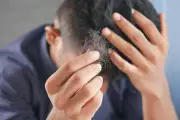 London Stress Crisis: 90% Report Hair Loss & Scalp Issues