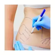 NHS Faces £20k Bills Per Patient for Botched Overseas Surgeries