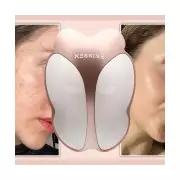 Winter Skin SOS: Grab Keskine's LED Mask at 80% Off in Limited Deal