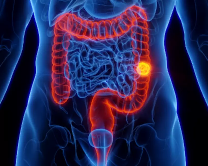Colorectal Cancer: Rising Cases in Youth and Prevention Strategies