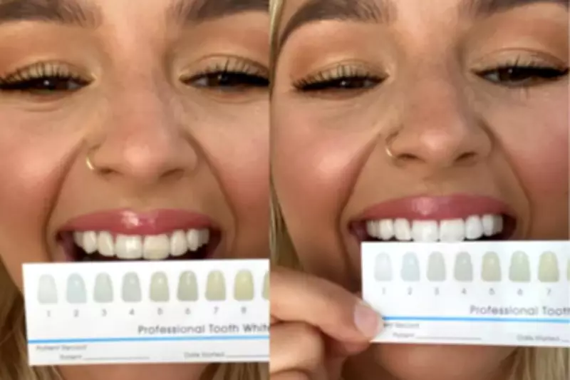 How I Transformed My Smile with the SmilePro Advanced Teeth Whitening Kit
