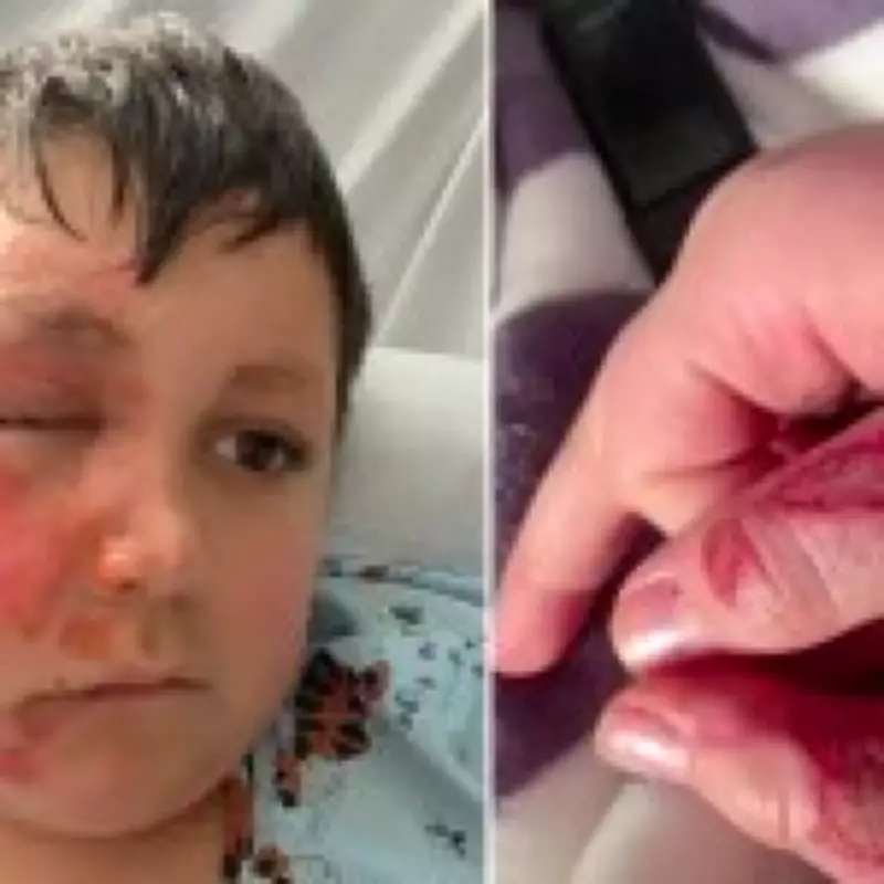 Nine-Year-Old Boy Suffers Severe Burns in Dangerous TikTok Microwave Challenge
