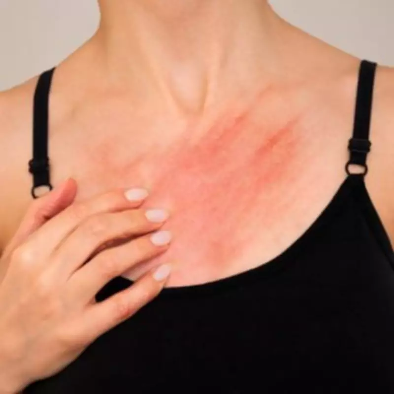 Scabies Surge: Expert Advice on Eradicating the Contagious Skin Condition