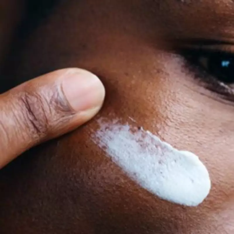 UK Trading Standards Issues Urgent Warning Over Illegal Skin Lightening Products