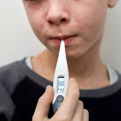 Measles Outbreak in London Schools: Symptoms and Urgent Vaccination Call