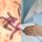 Elderly Man Dies from Rare Cholera-Like Disease in UK Hospital