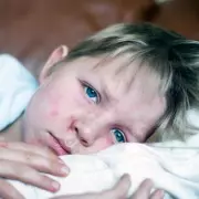 North London Measles Outbreak Hospitalizes 1 in 5 Children, UKHSA Confirms