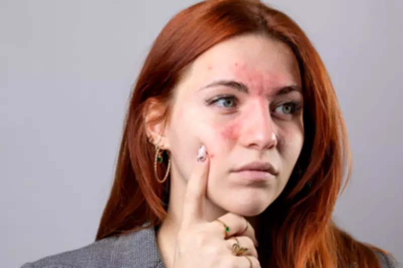 Beauty Editor's Redness Solution: Clinique Cream Earns Rave Reviews