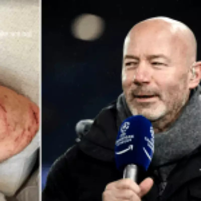Premier League Icon Alan Shearer Injured in Bicycle Accident After Hitting Pothole