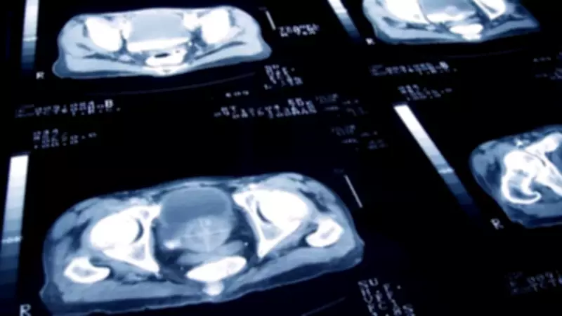 UK Cancer Death Rates Hit Record Low, Key Declines and Rises Detailed