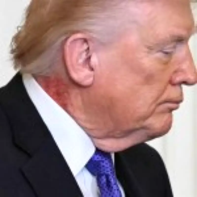 White House Explains Donald Trump's Neck Rash Amid Health Speculation
