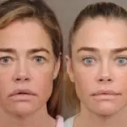Denise Richards' Facelift Revelation: Transparency or Luxury Marketing?