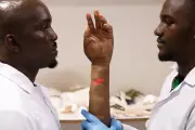 Nigerian Brothers Pioneer Lifelike Prosthetics for Africans, Filling Global Gap