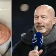 Premier League Icon Alan Shearer Injured in Bicycle Accident After Hitting Pothole