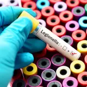 UKHSA Investigates Legionnaires' Disease Cases Across North and South West London