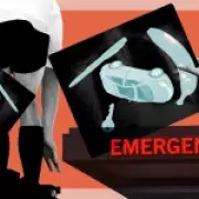 Why Men Over 50 Are More Prone to Rectal Object Mishaps