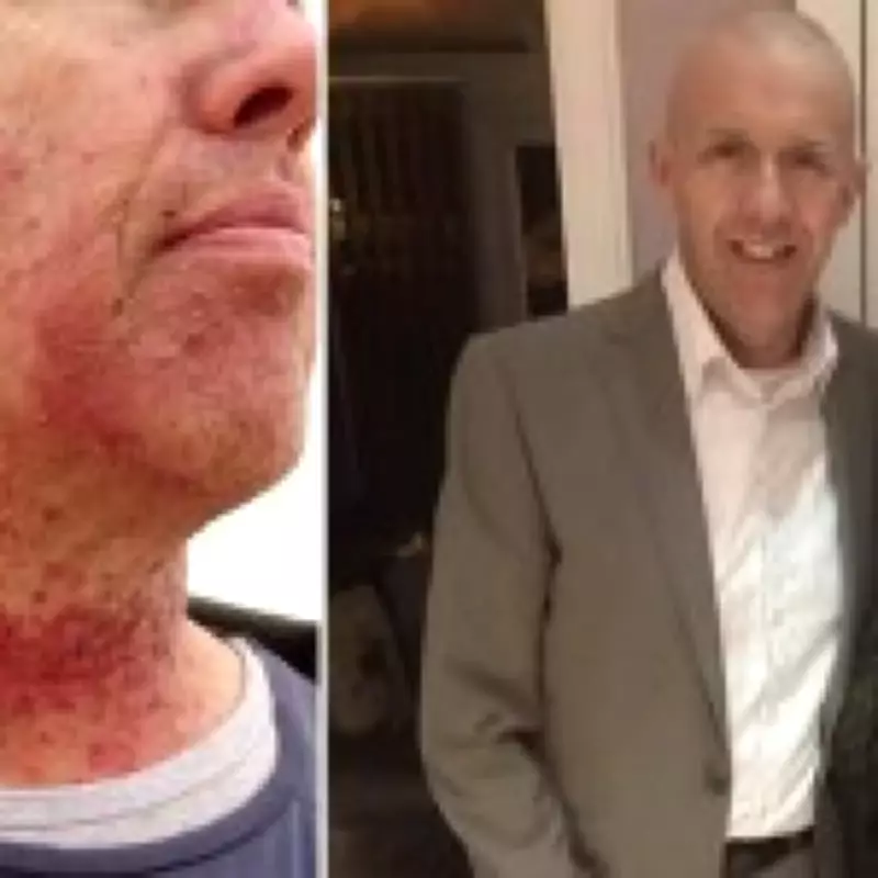 Dormant STI from Oral Sex Triggered Life-Threatening Throat Cancer After 30 Years