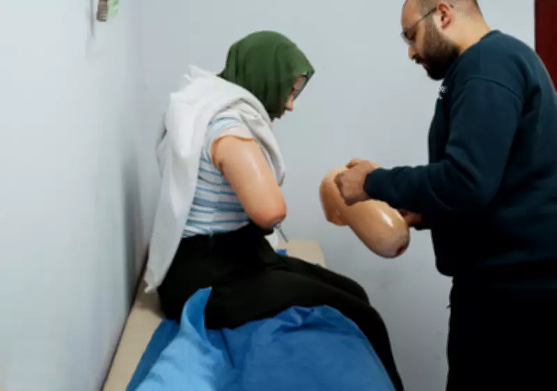 Gaza Amputees Face Dual Struggle: Physical Recovery and Legal Limbo in Egypt
