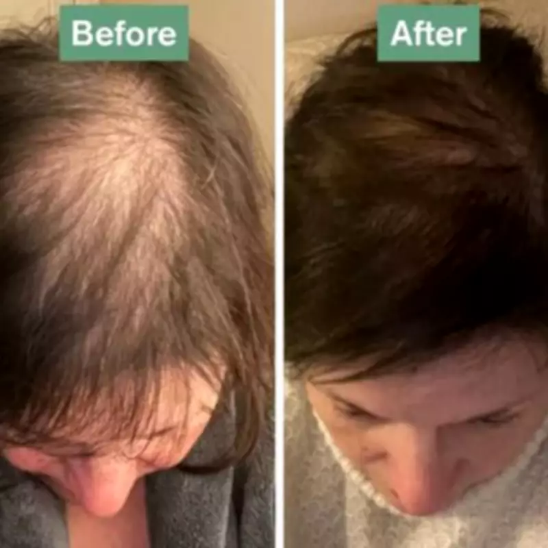 Hair Saviour Tablets at 56p a Day: Users Report Hair 'Growing Like Crazy'