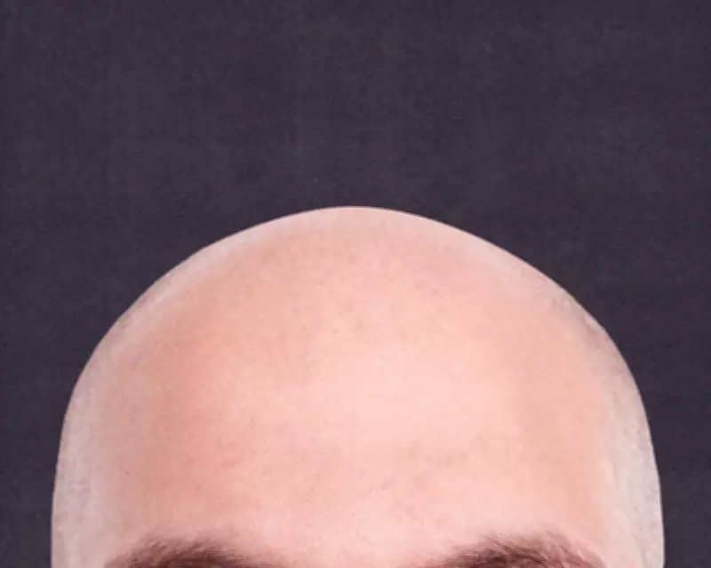 Reddit's r/bald Community: A Beacon of Support for Hair Loss and Self-Acceptance