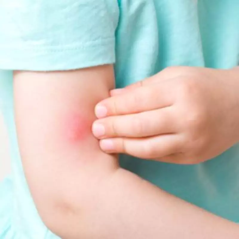 Spider Bite Hospital Admissions Double in England as False Widow Population Explodes