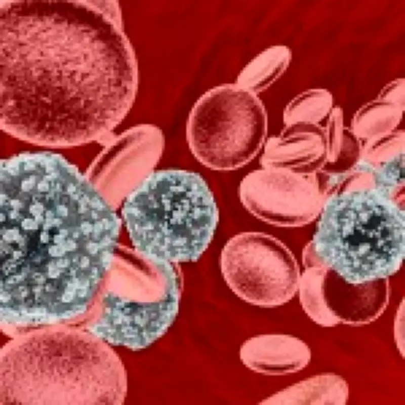 World First: HIV Patient Cured Through Brother's Stem Cell Transplant