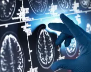 Alzheimer's 'Gamechanger' Drugs Show 'Trivial' Impact, Major Review Concludes