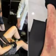 Taylor Momsen Hospitalized After Venomous Spider Bite During AC/DC Tour