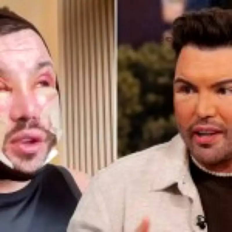 Bobby Norris Shows Swollen Facelift in New Video, Sparks Fan Confusion