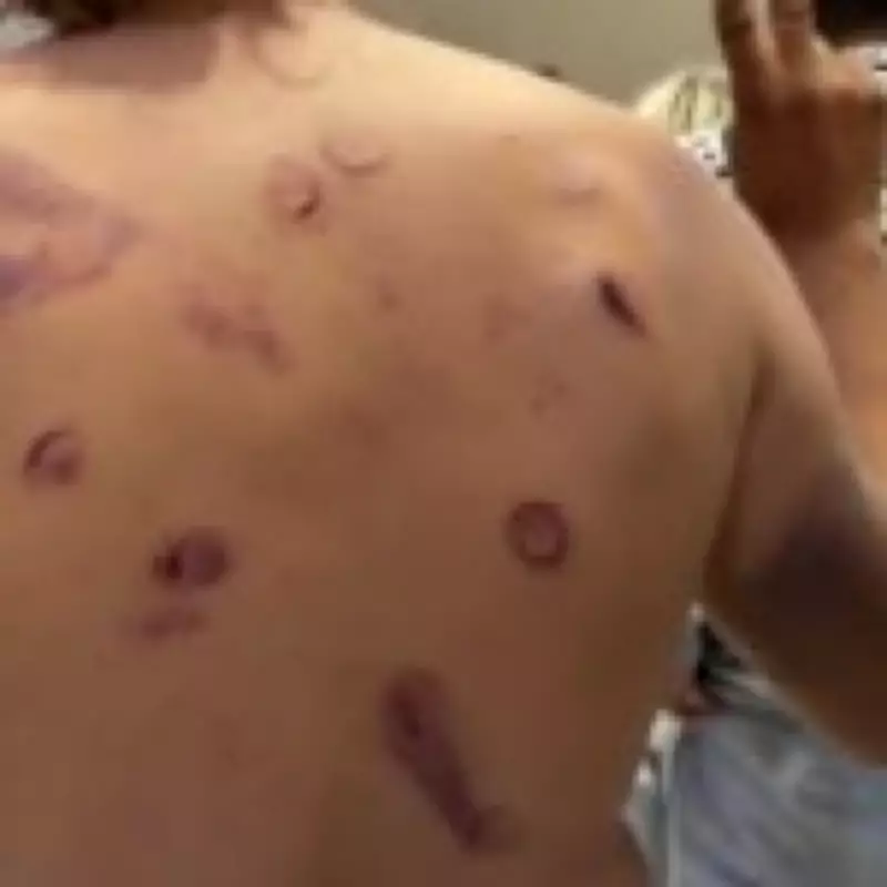Gaza Flotilla Activists Show Wounds from Israeli Detention