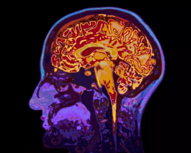 How Negative Expectations Can Make You Ill: The Nocebo Effect Explained