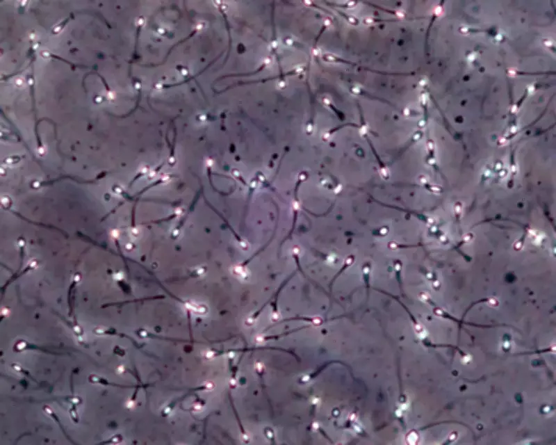 Man Produces Sperm from Testicular Tissue Frozen as Child in Breakthrough Trial